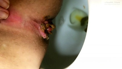 Screenshot 1 from ChunkyMonkey Soft Serve Shit