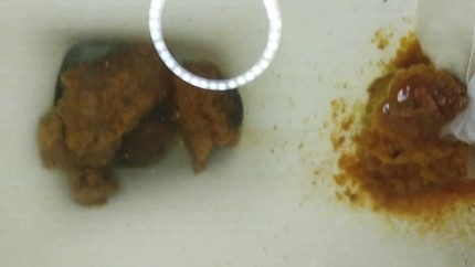 Screenshot 5 from Poop 27