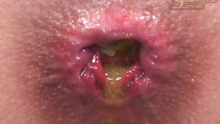 Screenshot 3 from SHITTY SYRINGE