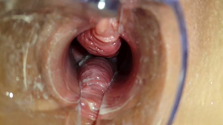 Through the Speculum Filled Pussy Part 1 with Anna Coprofield
